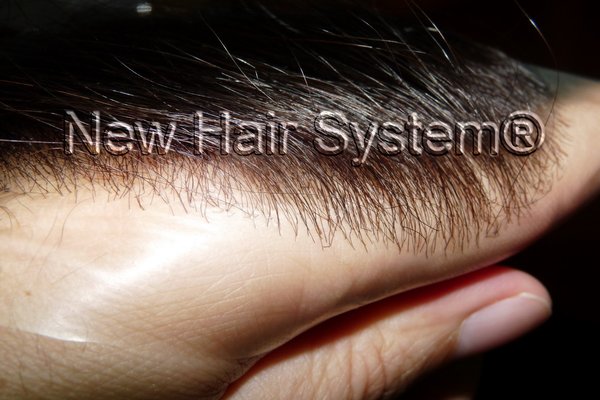 Protesi capelli in pellicola - New Hair System