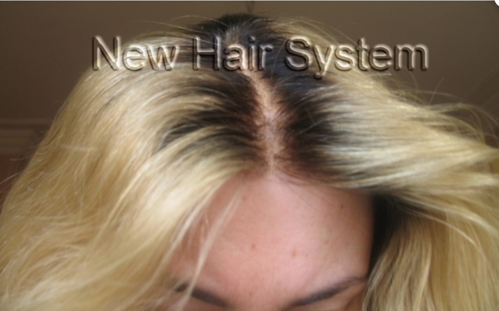 Protesi capelli donne - New Hair System