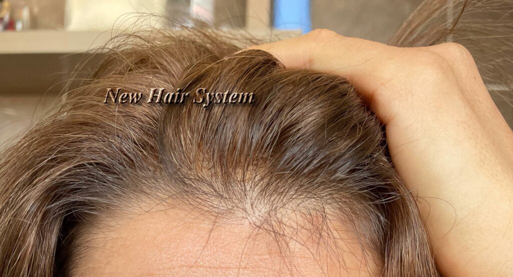 protesi capelli prezzo